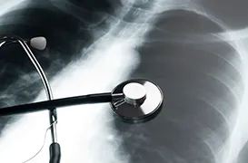 A stethoscope placed over a chest X-ray image