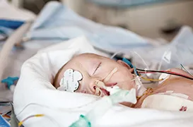 Infant in intensive care with monitoring sensors and medical support.